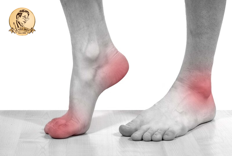 Bị đau bắp chuối chân