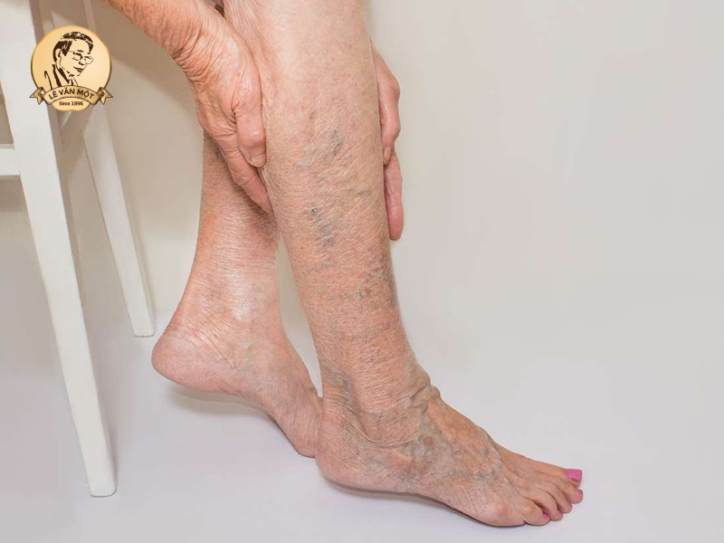 Bị đau bắp chuối chân