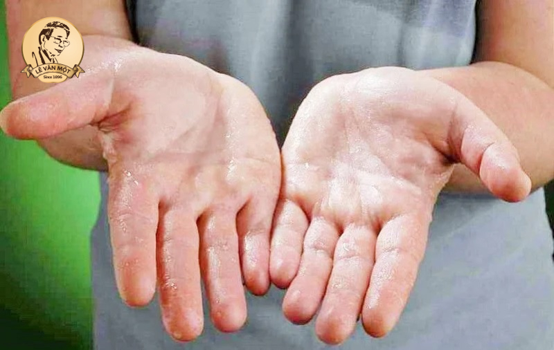 Cây thuốc nam chữa bệnh ra mồ hôi nhiều