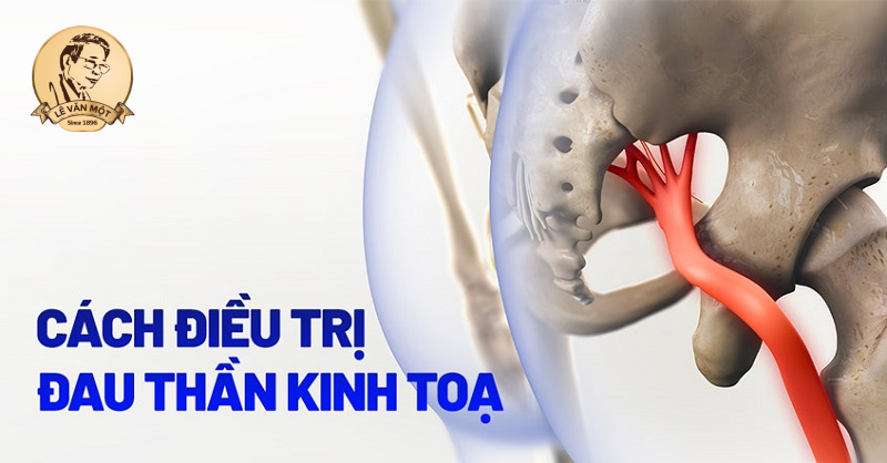 Chữa trị đau thần kinh toạ