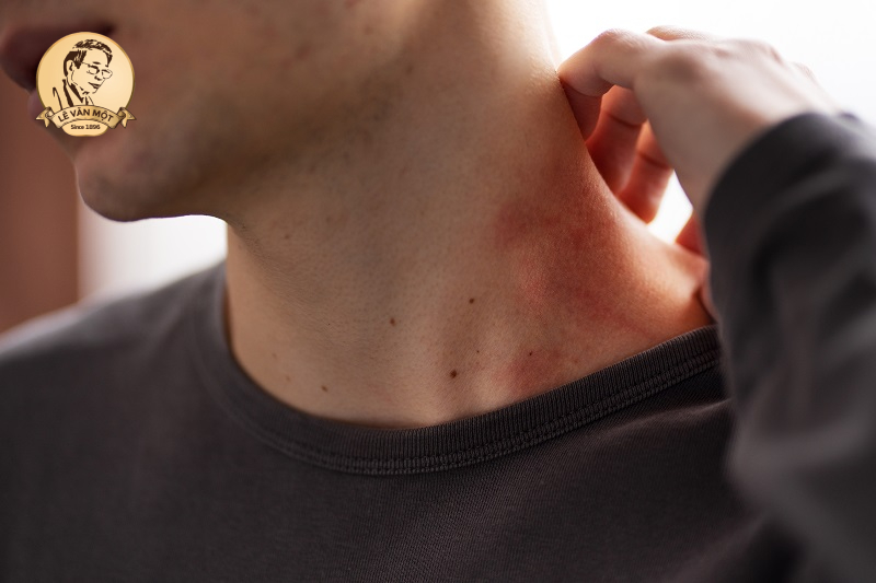 Dấu hiệu cơ thể nhiễm độc