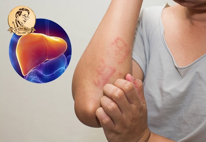 Thuốc giải độc gan tốt nhất trên thị trường Thuốc giải độc gan tốt nhất trên thị trường